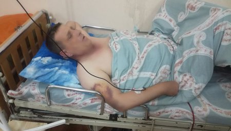 Директор симферопольских зоопарков дубиной разорвал садовнику селезенку